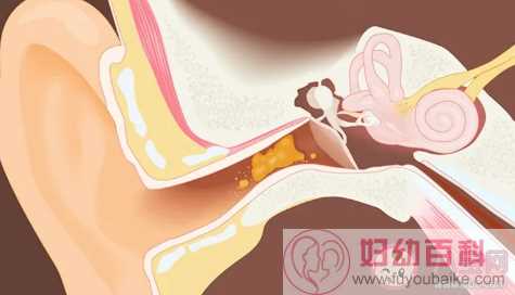 孕期激素变化会导致耳鸣吗 孕期耳鸣和听力下降的原因