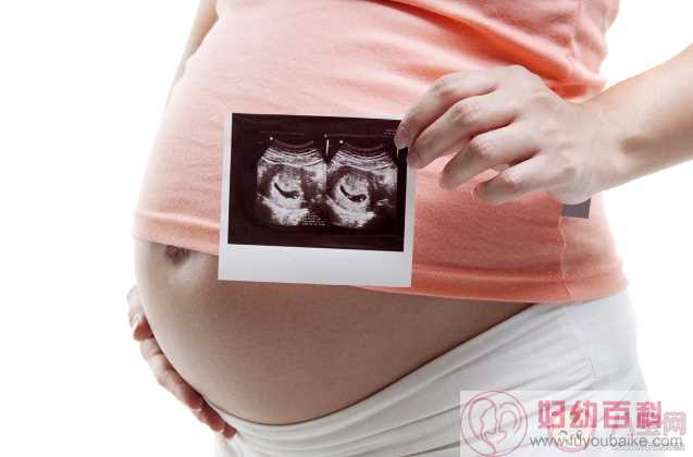四维彩超能检查出胎儿所有的缺陷吗 四维彩超检查有辐射吗