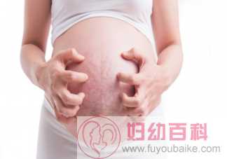 怀孕妊娠纹很痒怎么缓解 孕期妊娠纹为什么会痒