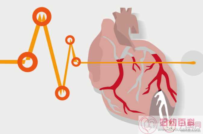 耳垂上有褶是心脏病的征兆吗 心脏病出现问题哪些先兆需要警惕
