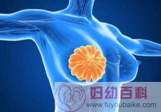 乳腺结节会变成乳腺癌吗 哪种乳腺结节需要处理