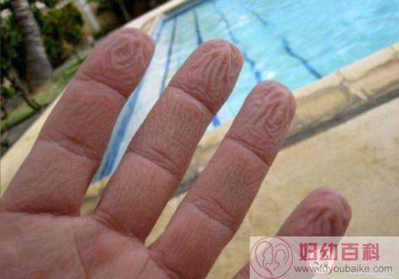 手指在水里泡久了为什么会变皱 为什么只是手指尖发皱