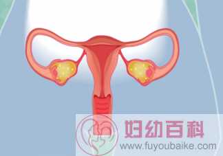 子宫内膜异位症可以预防吗 子宫内膜异位症高危人群有哪些