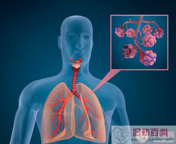 肺磨玻璃结节会演变成肺癌吗 什么是肺部磨玻璃结节