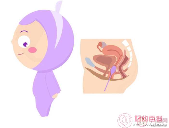 阴道哑铃真的有助于产后盆底肌修复吗 阴道哑铃可以整天戴着吗