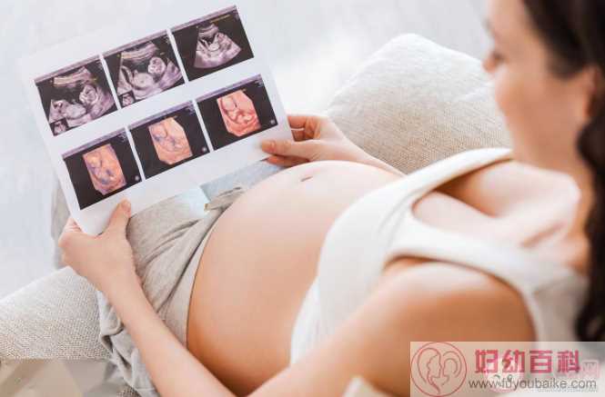 胎心监测不合格是胎儿缺氧了吗 胎心监护每周都要做一次吗