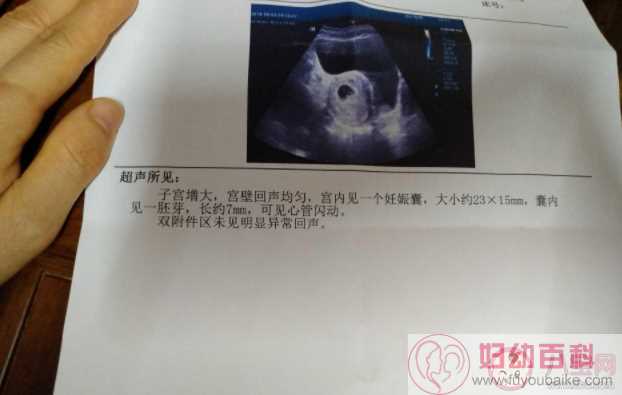 宝宝胎心胎芽一般几周会有 孕检不见胎芽胎心是有问题吗