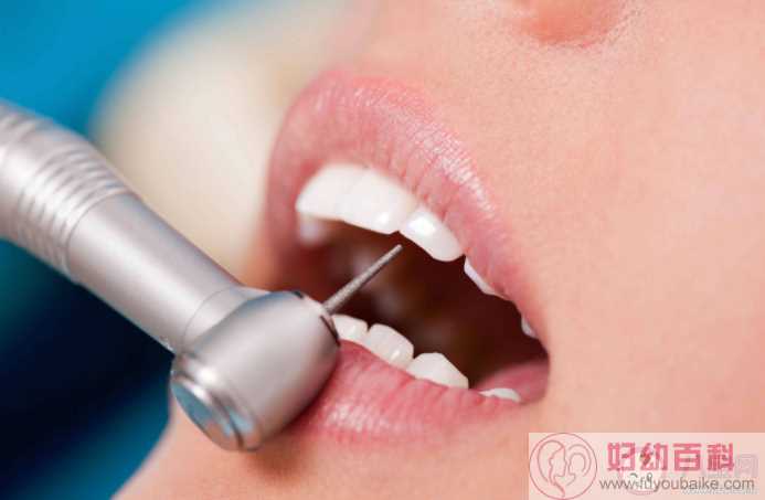 洗牙是怎么把牙缝冲大的 洗牙能把牙齿洗出裂纹吗