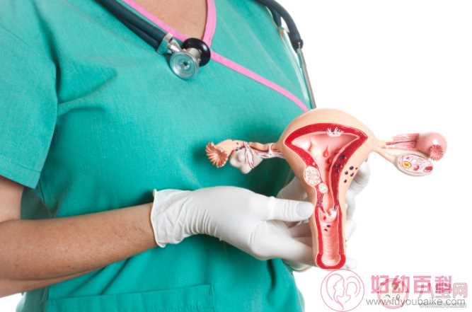 约70%卵巢癌患者确诊已是晚期 为什么卵巢癌难以发现