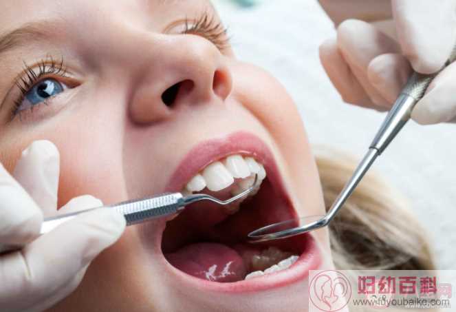 多生牙是什么意思有什么危害 多生牙需要拔除吗